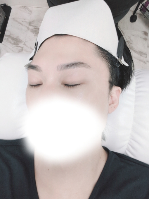 輝星(ｺｳｾｲ) ララピーリング